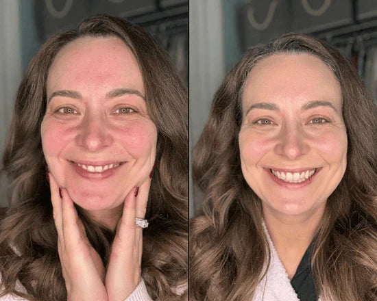 Customer smiling before and after beauty photo