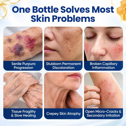 Grunsify VenoRescue Bee-Extract bruise skin recovery spray