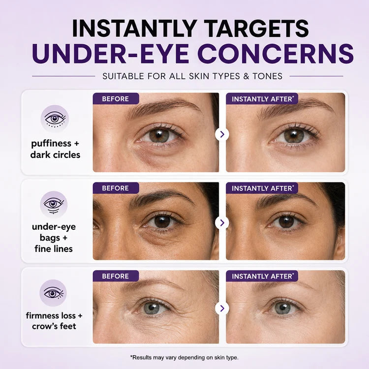 Instant Refresh Eye Gel — Reduce the Look of Eye Bags in Minutes 🔥
