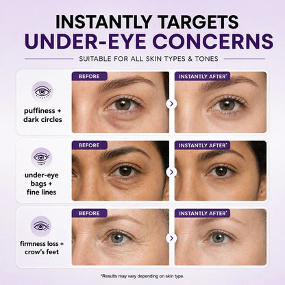 Instant Refresh Eye Gel — Reduce the Look of Eye Bags in Minutes 🔥