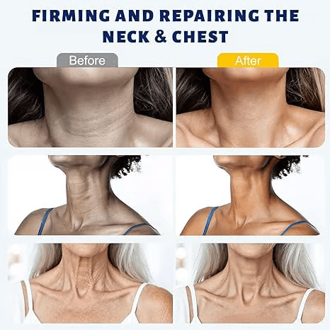 ✨Instant Neck Lift Cream  — 🧴 Infused with Retinol & Hyaluronic Acid | Firms the Neck, Reduces Wrinkles & Double Chin