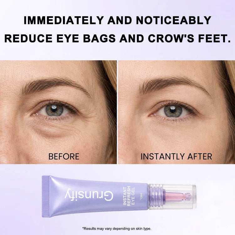 Instant Refresh Eye Gel — Reduce the Look of Eye Bags in Minutes 🔥