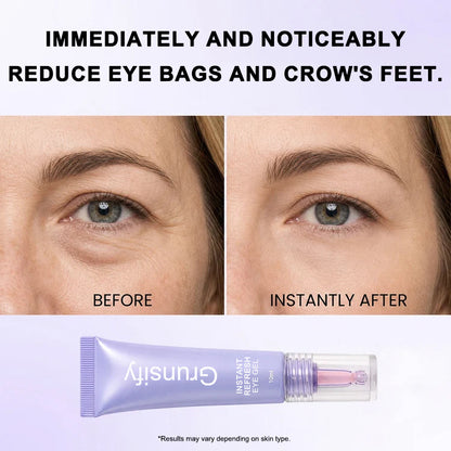 Instant Refresh Eye Gel — Reduce the Look of Eye Bags in Minutes 🔥