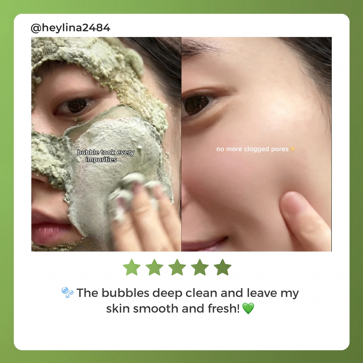 luyiquebeauty™  BOTA NICAL CLOW Bubble Deep Mask